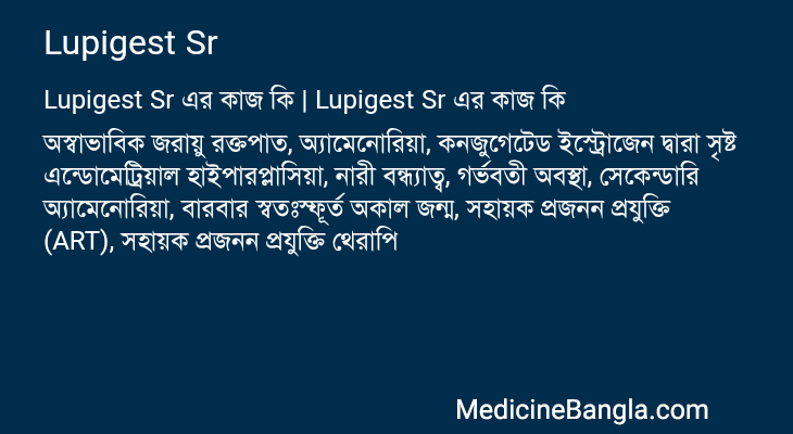 Lupigest Sr এর কাজ Lupigest Sr in Bangla