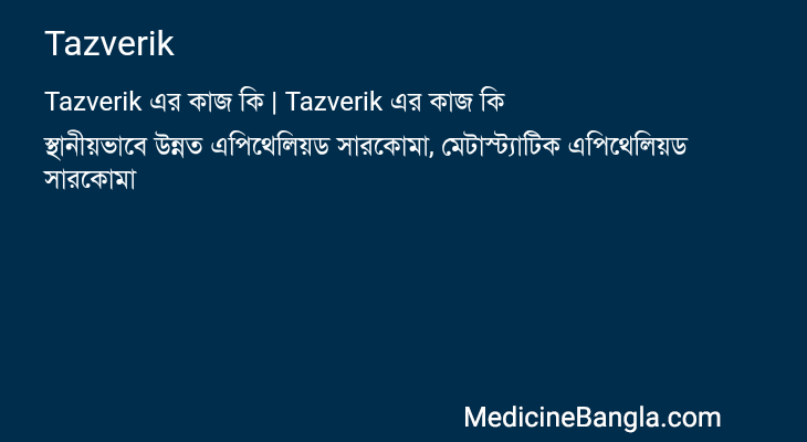 Tazverik এর কাজ Tazverik in Bangla